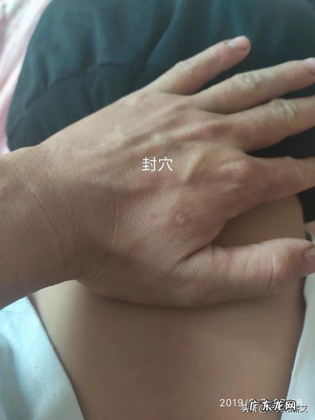 艾灸要不要开穴和封穴?有什么依据吗?