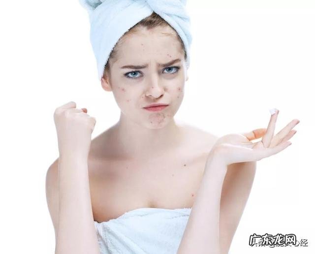 痘印怎么去掉最快最有效,有哪些方法