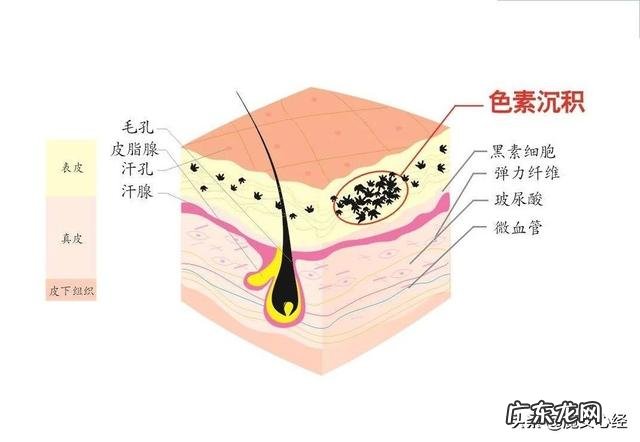 痘印怎么去掉最快最有效,有哪些方法