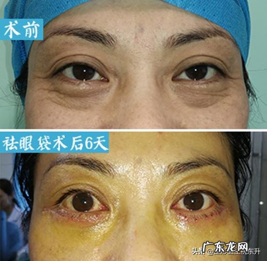 脚长得好看是怎样一种体验?