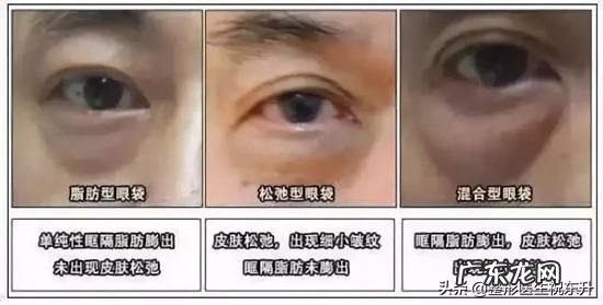 脚长得好看是怎样一种体验?