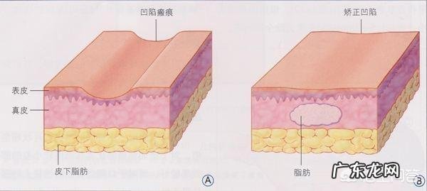 脂肪是由什么组成的脂肪燃烧分解后变成了什么