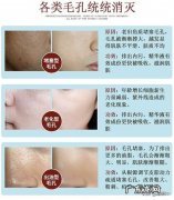 脸上皮肤像橘子皮一样怎么办