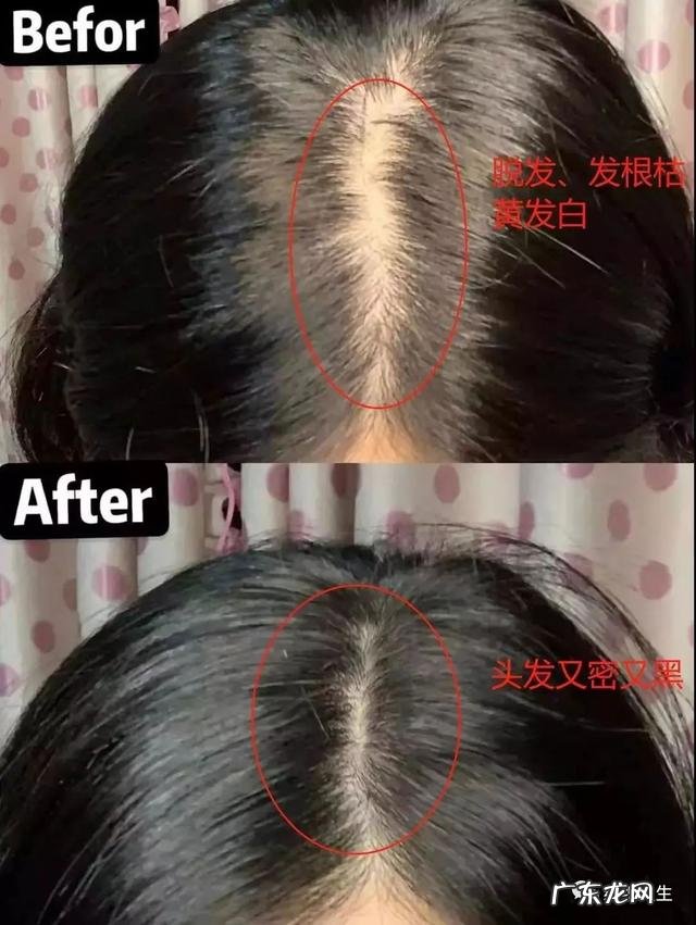 德国krauterhof洗发水正品 德国krauterhof洗发水怎么样