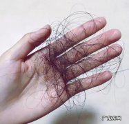 李佳琦强烈推荐防脱生发洗发水 生发用什么洗发水好