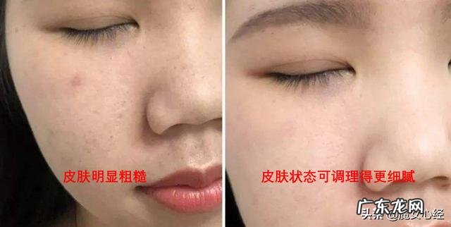 皮肤不知不觉变粗糙是因为螨虫吗