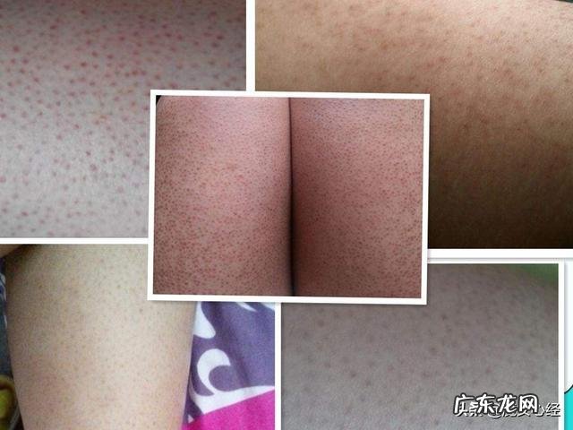 皮肤不知不觉变粗糙是因为螨虫吗