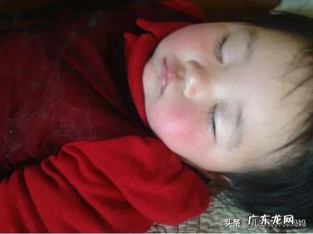 冬季宝宝的皮肤爱红、粗糙怎么办？