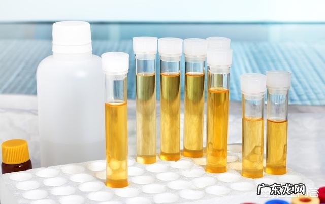 每天尿里泡沫多怎么物理调理?尿蛋白流失严重? 为什么尿里面泡沫少了蛋白多了