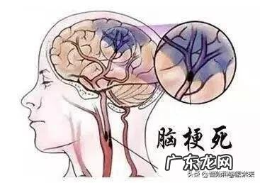 怎么现在这么多年轻人也会患脑梗?