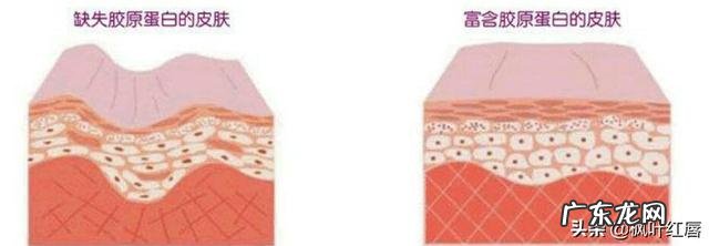 哪些方法可以改善皮肤暗黄和毛孔粗大