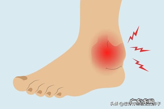 扭伤脚怎么消肿最快最有效?