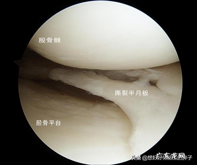 为什么运动完全身关节响？