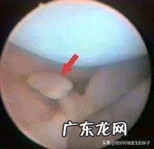 为什么运动完全身关节响？