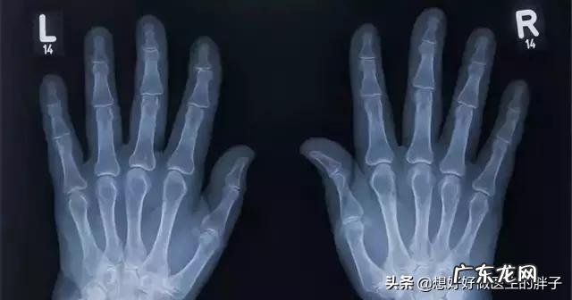 为什么运动完全身关节响?