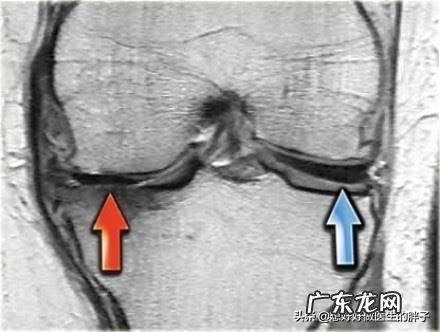 为什么运动完全身关节响？
