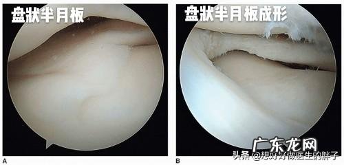 为什么运动完全身关节响？