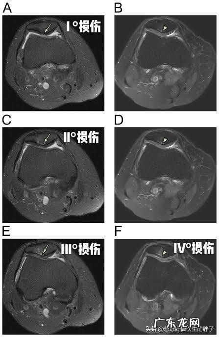 为什么运动完全身关节响？