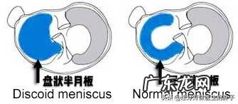 为什么运动完全身关节响？