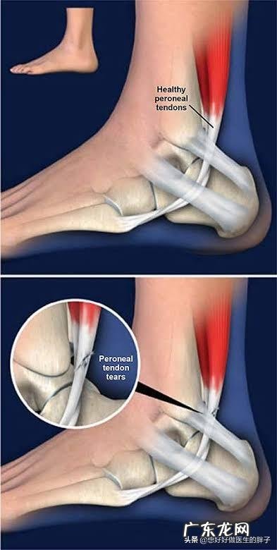 为什么运动完全身关节响?