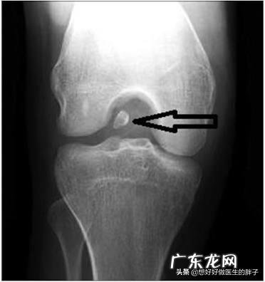 为什么运动完全身关节响？