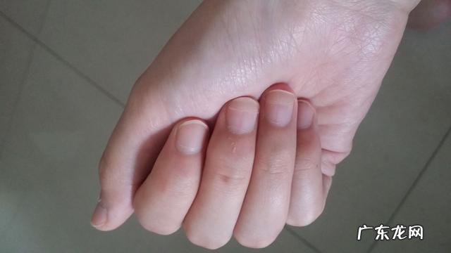 指甲上的月牙和健康有关系吗