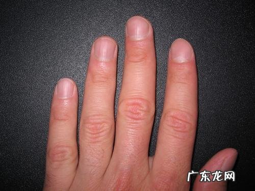 指甲上的月牙和健康有关系吗