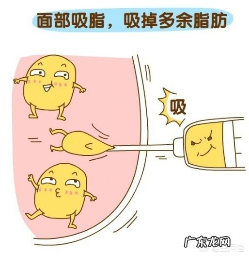 面部吸脂后会有什么影响?