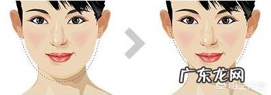 面部吸脂后会有什么影响?