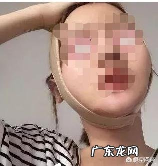 面部吸脂后会有什么影响?
