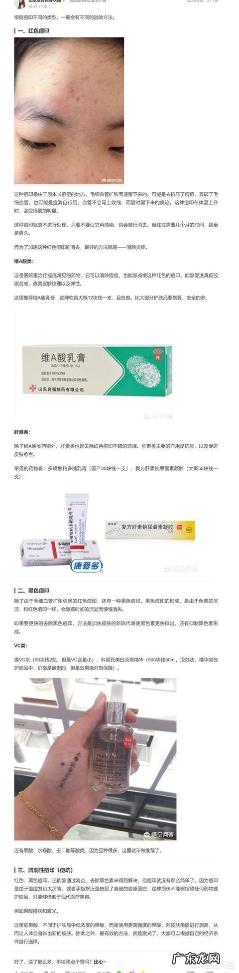 有痘印和黑头、毛孔粗大,适合使用什么护肤品或者药妆品?