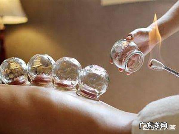 能随便拔罐吗?对身体好吗?