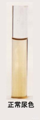 小便出血,可能是什么原因?