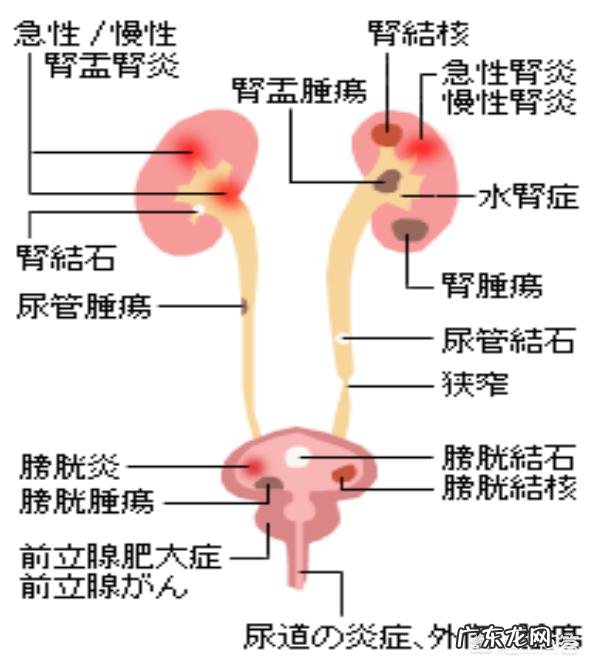 小便出血,可能是什么原因?