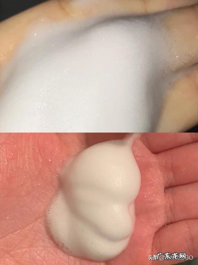 闭口粉刺与脂肪粒有什么区别?