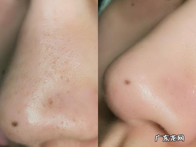 女性怎么锻炼使皮肤长期保持高弹性,肌肉不松垮?