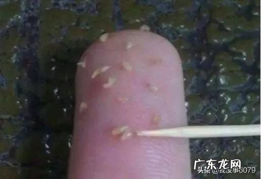 脸很油，毛孔里还有好多像小虫一样的东西，这是怎么了？ 脸油毛孔大用什么护肤品比较好