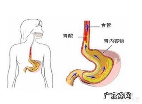 有些人认为吗丁啉副作用多,那它的替代品有哪些值得推荐?