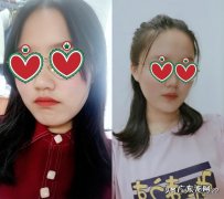 减肥脸不瘦，是一种什么样的体验？