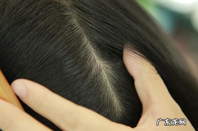 如何快速增长头发 如何加快头发生长速度留长发