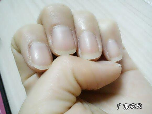 指甲有几个月牙才正常我的手指没月牙怎么办啊