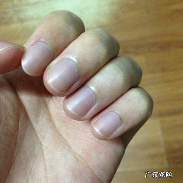 指甲有几个月牙才正常我的手指没月牙怎么办啊