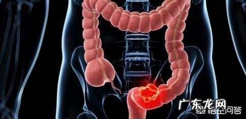 大便又细又稀是怎么回事?