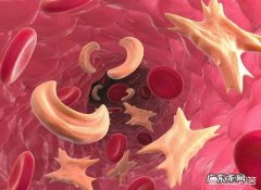 染发后多喝水可以排出毒素么