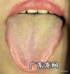 急性心肌梗死中医怎么zhi? 急性心肌梗塞用中医怎么康复