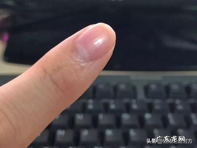 健康的手指甲是什么样子的