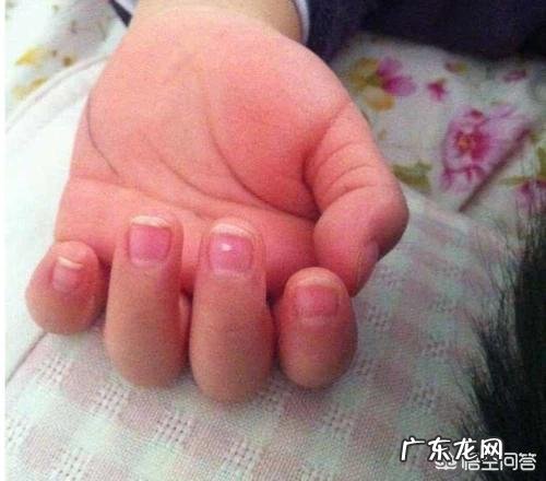 健康的手指甲是什么样子的