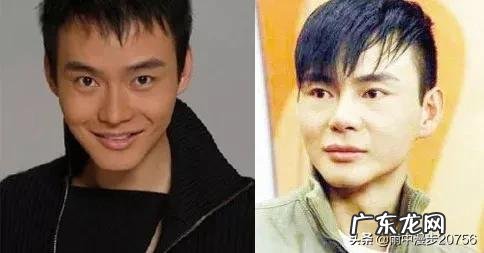 有哪些男明星公开承认过整形? 香港有哪些明星整形失败