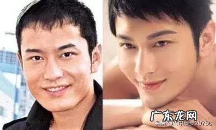 有哪些男明星公开承认过整形? 香港有哪些明星整形失败