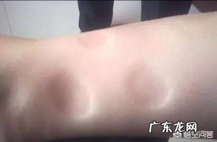 阳气下降,湿气升腾,阴寒之物摄入太多会怎么样?